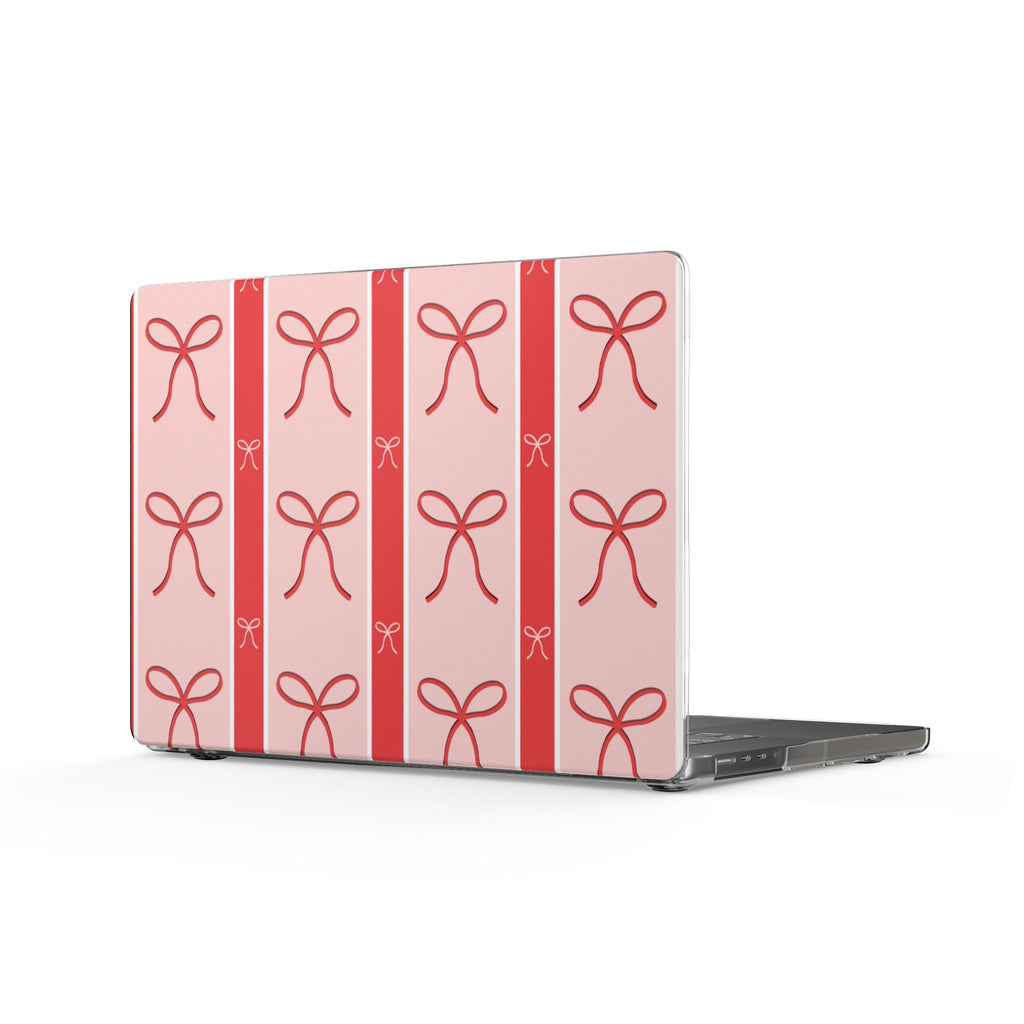 Clear MacBook Case | Pink Bow & Ribbon Pattern Laptop Cover | Protective Case for MacBook Pro & Air |